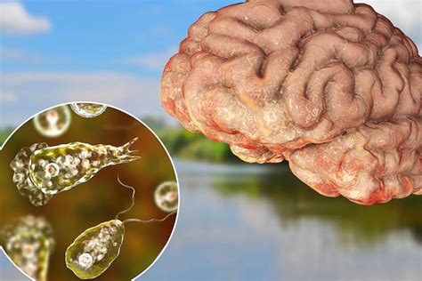  Naegleria Fowleri: Con sinh vật đơn bào bí ẩn với khả năng sinh sống độc đáo và nguy hiểm tiềm ẩn!