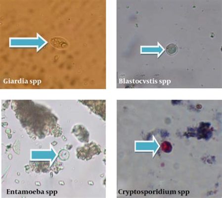  Understanding Uncinosporidium:  A Parasitic Protozoan Lurking Within the World's Waterways!